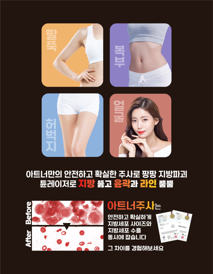 아트너주사